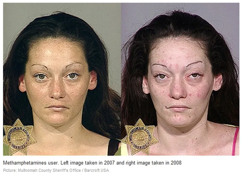 Methamphetamine. Before and After