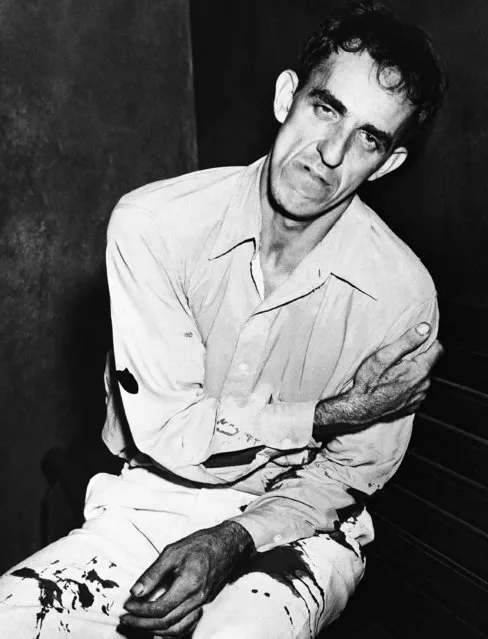 Willie Stevens, 36, confessed rapist of little girls, nurses bullet wounds in his left arm at the police station in New Orleans, La., August 31, 1943. The arm wounds were inflicted by Lt. Comdr. John P Vogt, of the U.S. Coast Guard, who opened fire on Stevens in the show-up room with two pistols after the Commander's 9-year-old daughter had identified Stevens as the attacker. (Photo by AP Photo)