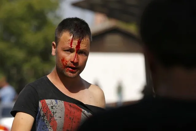 A man wounded during clashes between Syrian and Afghan migrants looks on at the train station in Beli Manastir, Croatia September 18, 2015. (Photo by Laszlo Balogh/Reuters)