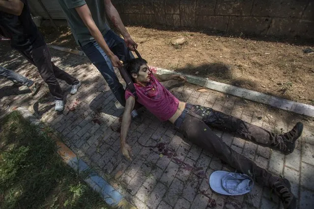 A man pulls a youth just after an explosion that killed dozens of people and injured scores of others, rocked the Turkish town of Suruc near the Syrian border, Monday, July 20, 2015.Turkish authorities said the attack appeared to be an Islamic State-inspired suicide bombing, but there was no immediate claim of responsibility for the blast. (Photo by Zeki Yavuzak/AP Photo)