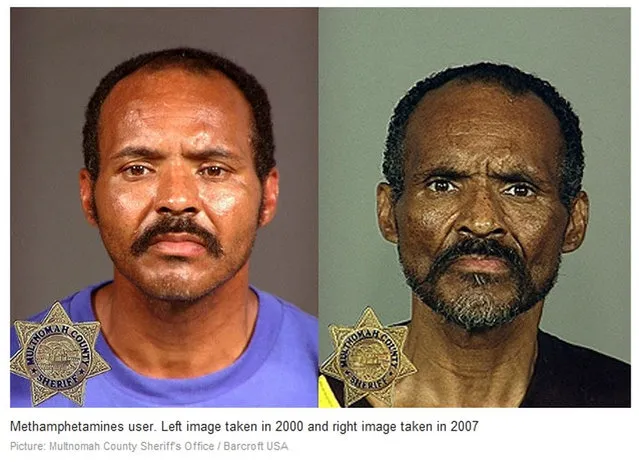 Methamphetamine. Before and After