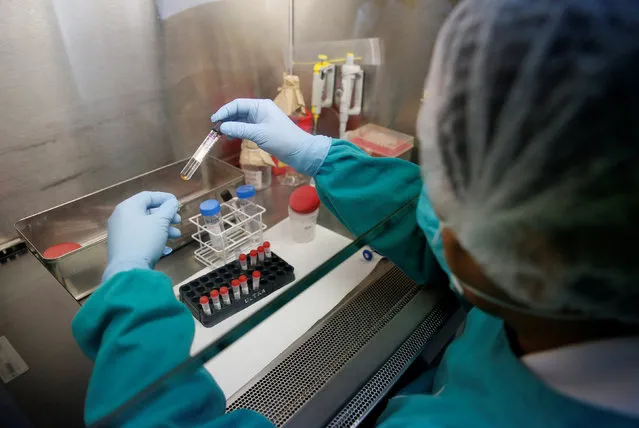 A health technician analyses blood samples for tuberculosis testing in a high-tech tuberculosis lab in Carabayllo in Lima, Peru May 19, 2016. (Photo by Mariana Bazo/Reuters)