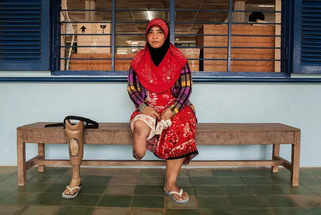 A woman poses with her prosthetic in the Handicap International Rehabilitation centre on January 17, 2014 in Kampong Cham, Cambodia. Cambodia is one of the most heavily mined countries in the world; some estimate that there is as many as ten million mines in a country of 14.5 million people. (Photo by Omar Havana/Getty Images)