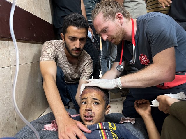 A wounded Palestinian, injured in an Israeli strike on a UNRWA school shelter, receives treatment at Al-Aqsa Martyrs Hospital in Deir Al-Balah, in central Gaza Strip on June 6, 2024. (Photo by Doaa Rouqa/Reuters)