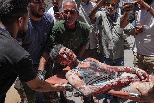 An injured youth is brought to the Al-Aqsa Martyrs Hospital in Deir al-Balah, after the Israeli bombardment of agricultural land in the area of al-Maghazi in the central Gaza Strip on June 11, 2024, amid the ongoing conflict between Israel and the Palestinian Hamas militant group.  (Photo by Bashar Taleb/AFP Photo)