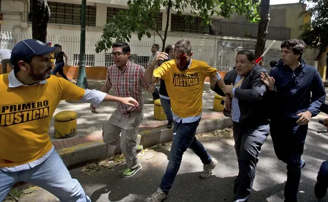Opposition lawmaker Juan Requesens, center, is evacuated by his colleagues after begin injured by alleged pro government supporters as they protest outside of the Ombudsman's offices in Caracas, Venezuela, Monday, April 3, 2017. (Photo by Ariana Cubillos/AP Photo)