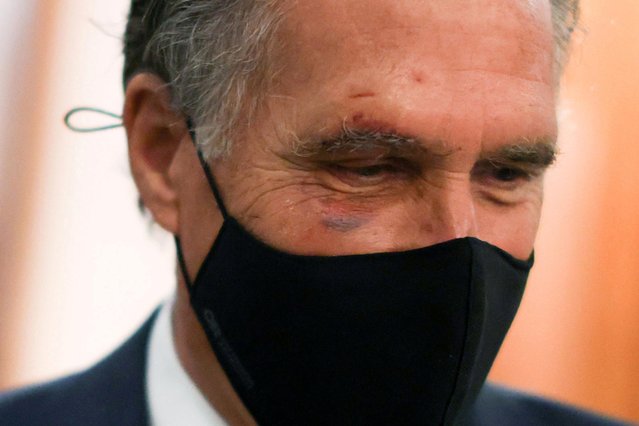 U.S. Senator Mitt Romney (R-UT) sports a bit of a black eye and small facial cuts from a fall over the weekend as he speaks with reporters about potential efforts to raise the minimum wage at the U.S. Capitol in Washington, U.S. March 1, 2021. (Photo by Jonathan Ernst/Reuters)