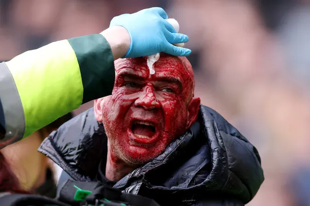 A fan with a bloodied face is escorted away by local police during the Emirates FA Cup Fourth Round match between West Bromwich Albion and Wolverhampton Wanderers at The Hawthorns on January 28, 2024 in West Bromwich, England. (Photo by Getty Images/Getty Images)