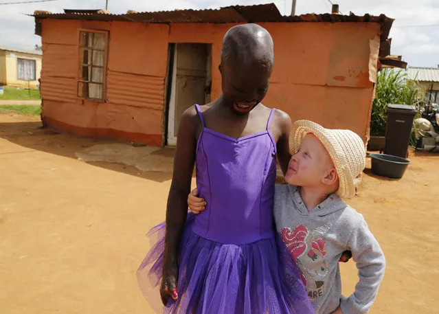In this photo taken Sunday, January 6, 2019, 11-year-old burn victim Perlucia Mathebule, left, and her 4-year-old sister, Buhle who has albinism, pose for a photograph outside their one-room shack in Ekangala, South Africa, where the two are spending rare time with one another during the school holidays. Perlucia was badly burned at the age of 6 months and Buhle was born with albinism. (Photo by Denis Farrell/AP Photo)