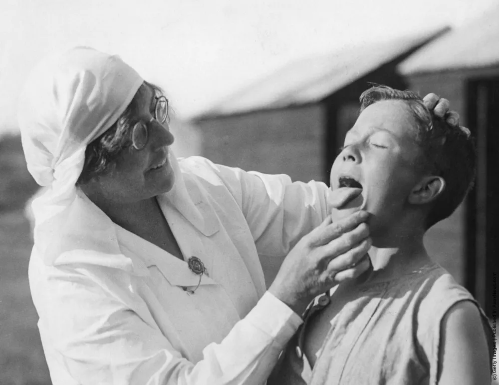 Simply: Tongue. Part II