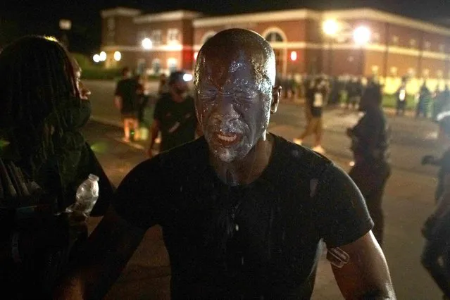 Filmmaker Chris Phillips is treated after being maced during a protest marking six years since 18-year-old Michael Brown Jr. was shot dead by the police in Ferguson, Missouri, U.S. August 9, 2020. (Photo by Lawrence Bryant/Reuters)