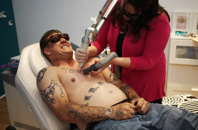 Chad Lambert reacts as he has a tattoo of his ex-wife's name removed from his chest with a laser by Jill France at her "What Were You Inking" clinic in downtown Denver. France does pro bono tattoo removal for Colorado Department of Corrections ex-convict clients like Lambert who is enrolled in the Peer 1 Therapeutic Community. (Reuters/Rick Wilking)