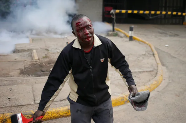 A protester beaten by Kenyan policemen bleeds during clashes in Nairobi, Kenya May 16, 2016. (Photo by Goran Tomasevic/Reuters)