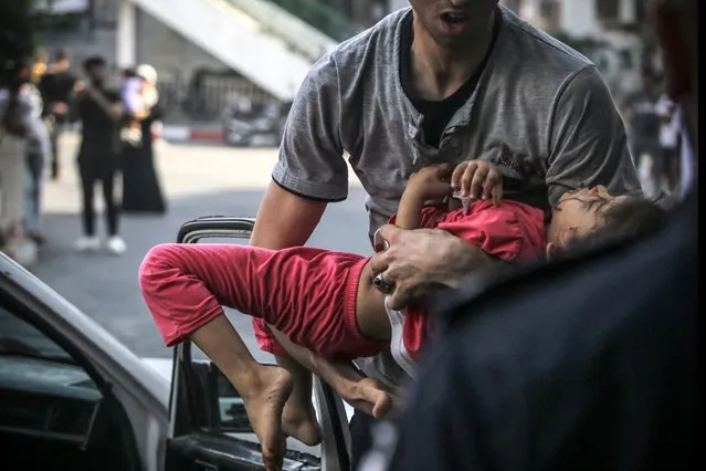 An injured Palestinian child is carried to a hospital following an Israeli air strike on Gaza City, on August 5, 2022. The Israeli military said today it launched air strikes on Gaza, which were witnessed by Palestinians in central Gaza City. (Photo by Anas Baba/AFP Photo)