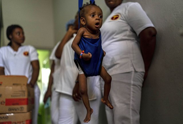 A child suffering from malnutrition is weighed by health workers at La Paix University Hospital, in Port-au-Prince, Haiti, Wednesday, May 8, 2024. (Photo by Ramon Espinosa/AP Photo)