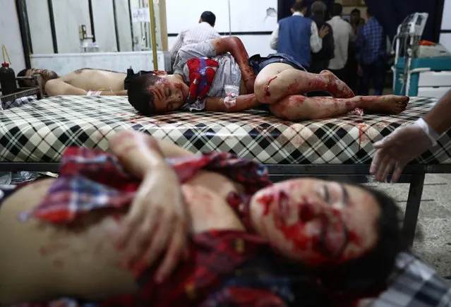 Wounded Syrian children receive medical attention at a make-shift hospital following reported government air strikes on the rebel-held town of Douma, east of the capital Damascus on September 12, 2016. A ceasefire brokered by Russia and the United States took effect in Syria at sundown, despite scepticism over how long the truce in the five-year conflict would hold. (Photo by Abd Doumany/AFP Photo)