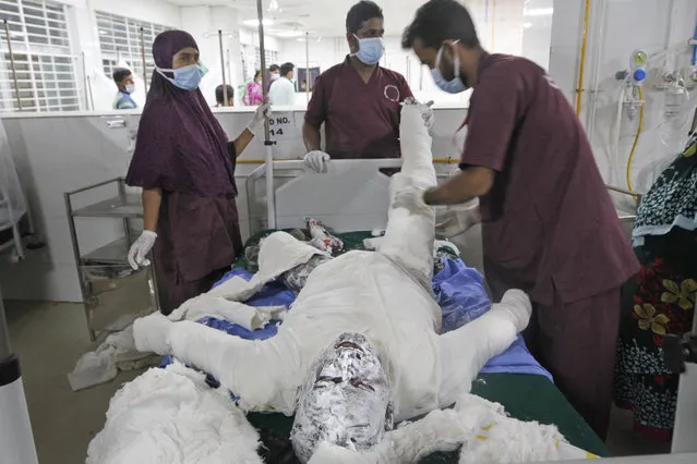 Doctors treat a burn Muslim worshipper in a hospital in Dhaka, Bangladesh, Saturday, September 5, 2020. Dozens of Muslim worshipers suffered burn injuries critically during evening prayers after explosions of a gas pipeline installed underground near a mosque outside Bangladesh capital, officials said Saturday. (Photo by Abdul Goni/AP Photo)