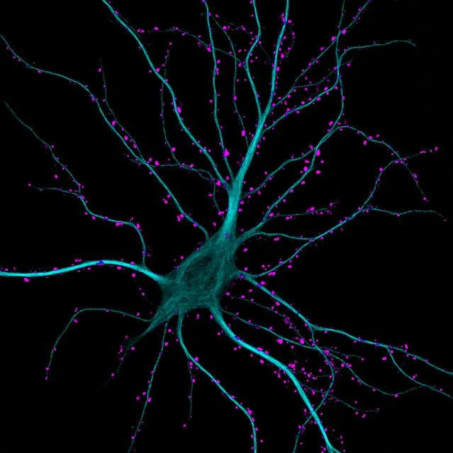 Dr. Kieran Boyle of the University of Glasgow, in Scotland took this image of a brain cell in the hippocampus, receiving excitatory contacts. It is enlarged 63 times. (Photo by Dr. Kieran Boyle)