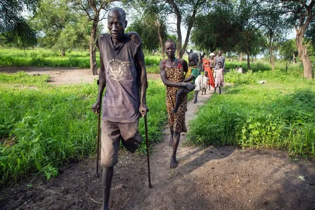 James Thorm an amputated and displaced man, walks with a displaced family on July 4, 2017 in an area where hundreds of displaced people live in Padding, Jonglei, South Sudan. Fighting between Government and opposition forces in April 2017 pushed thousands of civilians to be displaced in Padding and Lankien, both are still under opposition control. The massive displacement brought an outbreak of cholera and a serious need of health assistance, drinking water and food distribution among the population, according to the local leaders. (Photo by Albert Gonzalez Farran/AFP Photo)