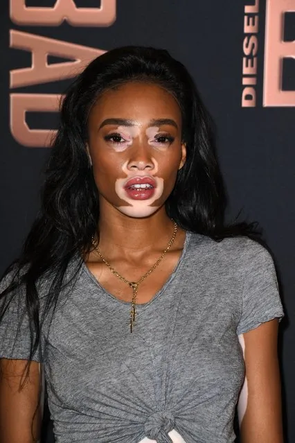 Model Winnie Harlow attends the Diesel Party for the Launch of New Fragance For Men on June 23, 2016 in Paris, France. (Photo by Pascal Le Segretain/Getty Images)