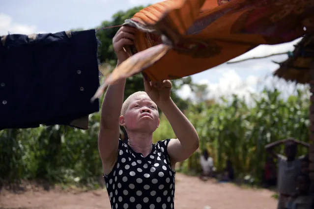 In this photo taken Sunday, February 9, 2020, Catherine Amidu hangs out washing to dry outside her home in Machinga, Malawi. People with albinism in several African countries live in fear of being abducted and killed in the mistaken belief that their body parts carry special powers and can be sold for thousands of dollars. 17-year-old Amidu survived an attempt on her life in 2017. (Photo by Thoko Chikondi/AP Photo)