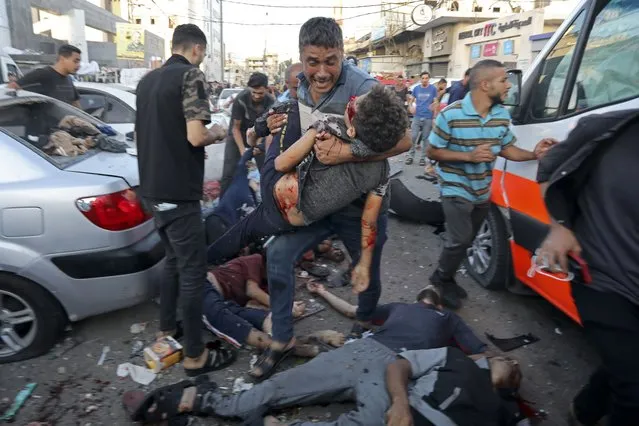 A man steps over the bodies of dead and injured Palestinians lying on the ground following an Israeli airstrike outside the entrance of the al-Shifa hospital in Gaza City, Friday, November 3, 2023. (Photo by Abed Khaled/AP Photo)