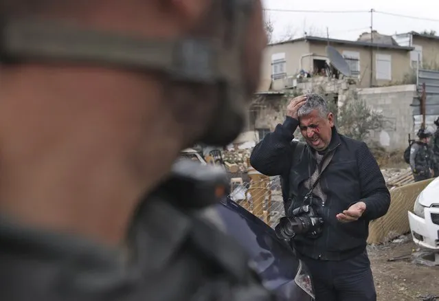 Associated Press photographer Mahmoud Illean reacts after being attacked by Israeli police while covering a demonstration in the east Jerusalem neighborhood of Sheikh Jarrah, Friday, December 17, 2021. Illean had been covering a weekly demonstration where longtime Palestinian residents are battling efforts by Jewish settlers to evict them from their homes. He did not suffer any fractures and returned home from the hospital several hours later with a bruised face and head and back pain. (Photo by Ahmad Gharabli/AFP via AP Photo)