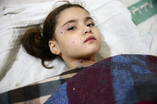 An injured girl rests in a field hospital, after an air strike on a kindergarten in the rebel-held besieged city of Harasta, in the eastern Damascus suburb of Ghouta, Syria November 6, 2016. (Photo by Bassam Khabieh/Reuters)